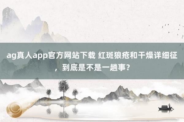 ag真人app官方网站下载 红斑狼疮和干燥详细征，到底是不是一趟事？